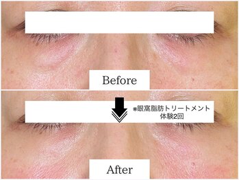 グラシア(gracia)/シミ・毛穴専門店gracia