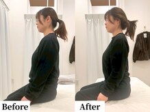 ソレア(Solea)/全身のコリ・巻き肩・むくみ改善