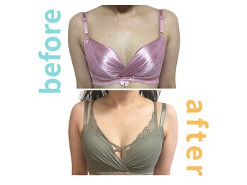 シエル(Ciel)/バストアップ施術４回→１０回