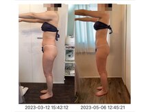 サロン ド カシェット 銀座/お客様のビフォーアフター例