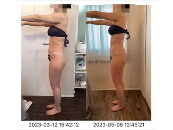 サロン ド カシェット 銀座/お客様のビフォーアフター例