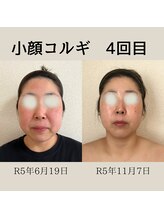 リーブル(LIBRE)/小顔コルギ　４回