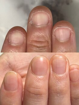 ハッチネイル(HACCI nail)/お客様Beforeafter