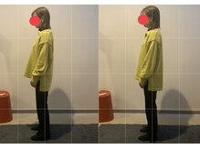 小顔矯正整体サロン イクサス(IxAS)/初回での<before&after>