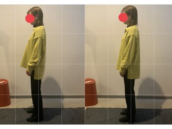 小顔矯正整体サロン イクサス(IxAS)/初回での<before&after>