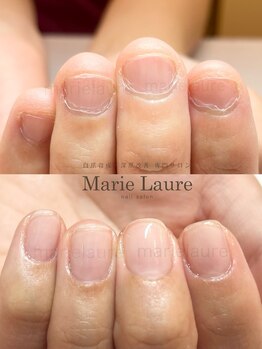 マリーロール 梅田店(Marie Laure)/深爪矯正/自爪育成/自爪風