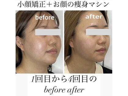 エミナル(EMINARU)の写真