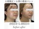 エミナル(EMINARU)の写真