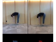 徳島藍住整骨院 ザ ビー(THE B)/ピラティス初回体験before/after