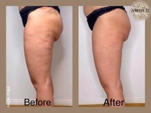 アムール 麻布十番(Amour)/エンダモロジーアライアンス