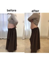 ジョワイユ(Joyeux)/腸の位置でお腹は変わる