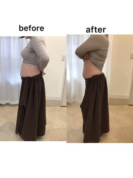 ジョワイユ(Joyeux)/腸の位置でお腹は変わる