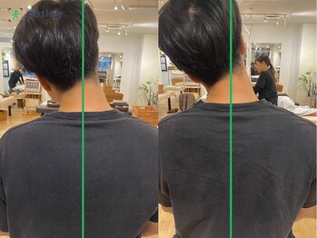 グレフル鍼灸接骨院 整体院 心斎橋/整体/肩こり/マッサージ/腰痛