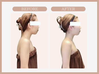 アコガレコガオ 弘前店/