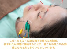 名古屋鍼灸 美容健康院/美容鍼