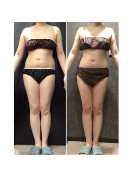 フローボディ 新山口店(flow BODY)/山口のエステはflow BODY