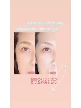 エンジェル(Angel)/