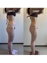 サロン ド カシェット 銀座/お客様のビフォーアフター例