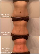 ウルラ(ULULA)/お試し脂肪冷却2cup！