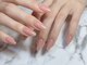 トラストネイル 垂水(TRUST NAIL)の写真/TRUST NAILのフィルインは驚きの長持ち！深爪育成/巻き爪矯正などの爪悩み解決サロン♪実証画像ご紹介中◎
