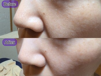 スノードロップ(snowdrop)/