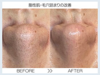 フェアリー(fairy)/