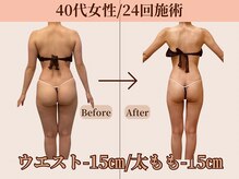 ベルホワイト(Belle White)の雰囲気（どんな体型の方も☆人生初のダイエット成功者に♪）