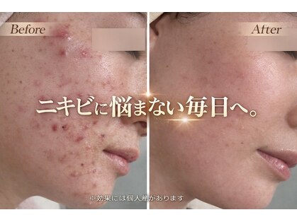 ハクビューティー(HAKU BEAUTY)の写真