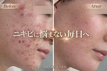 ハクビューティー(HAKU BEAUTY)