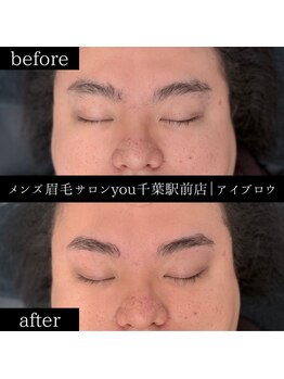 ユー 千葉駅前店(you)/ビフォ－アフター写真