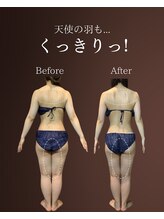 レディラック 大阪梅田本店(Lady Luck)/マイクロウェーブリフトコース