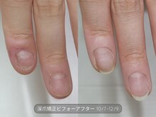 ミンスネイル(Mins Nail)/