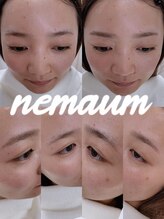 ネマウム(nemaum)/