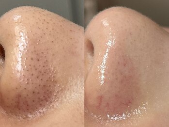 フレーズ(fraise)/