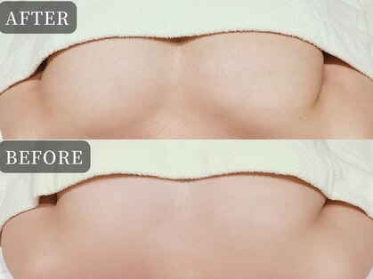 ビューティーサロンエー 心斎橋店(Beauty Salon A)の写真