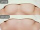 ビューティーサロンエー 心斎橋店(Beauty Salon A)の写真