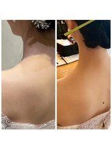 サンテボーテ(Sante Beaute)/痩身ブライダルエステ