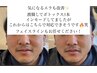 気になるエラにも◎筋肉からしっかりほぐして引き上げる！
