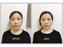 ソロウノ 平和島本院/ファイシャルケア