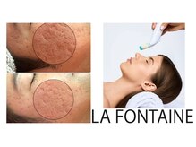 オシュン 北九州(Oshun)の雰囲気（肌管理はラフォンテ一択。WINBACKとの併用で相乗効果UP！）