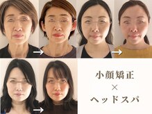 まどろみ(madoromi)の雰囲気(顧客様人気♪【小顔矯正】加齢による顔変化お悩みの方へおすすめ)