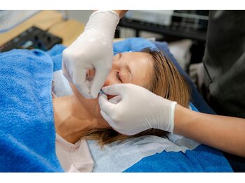 ビランシア(BILANCIA)の写真/【ニキビケア・肌質改善に特化！】ダーマ美容鍼¥7,200！鍼で肌質がみるみる変わる!!感動体験♪