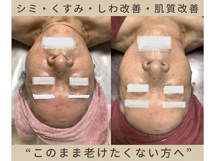 ピュリフィケーション(Purification)の写真