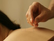 もえぎ野整骨院【整体・鍼灸・美容ばり・産後矯正・骨格矯正】の雰囲気(整体や鍼灸、美容鍼、産後の悩みや骨格矯正までお任せください♪)