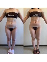 サロン ド カシェット 銀座/お客様のビフォーアフター例