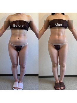 サロン ド カシェット 銀座/お客様のビフォーアフター例