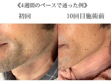 サロン ド アピール(salon de APPEAL)/