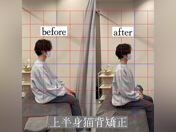 りかり 明石大久保院/猫背改善!理想の姿勢へ