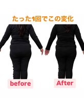 ヨサパーク メリー(YOSA PARK merry)/たった一回でこの変化