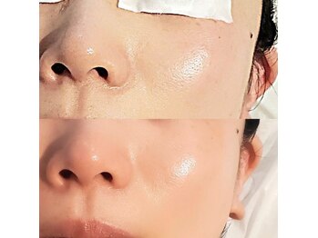 グレアージュ(GLEAGE)/たるみケア エイジングコース!